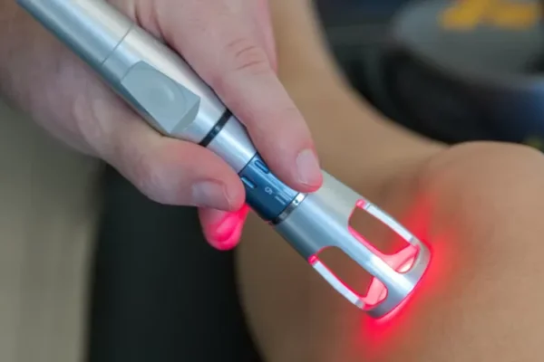 Cold Laser Therapy